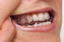 Wendy Shorr DDS in Skokie IL makes custom oral appliances for snoring and sleep apnea