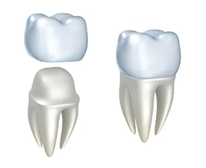 dental crown, Wendy Shorr DDS, Skokie IL dental services